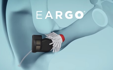 Eargo Hearing Aids